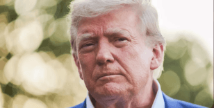 Trump'ın sağlık durumu gündemde: Bacaklarındaki şişlik ve morlukların nedeni açıklandı