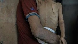 UNRWA Genel Komiseri: Gazze’de açlık herkesi yavaş ve sessiz bir ölüme mahkum etti